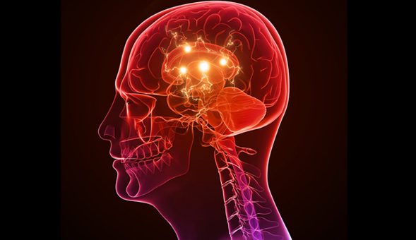Epilepsia