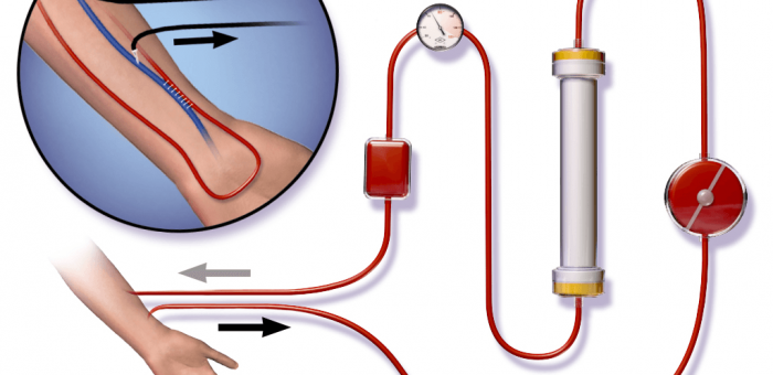 O que é a hemodiálise