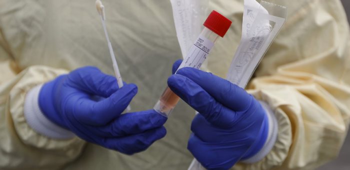 Afinal que testes existem à COVID-19?